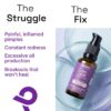 Anti Acne Serum